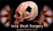 Puzzle: Inca Skull Surgery.